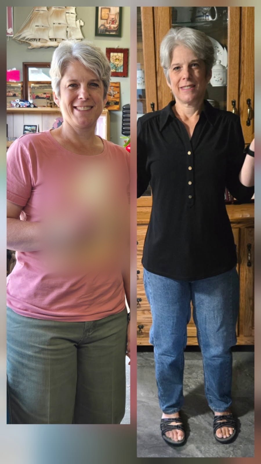 Before and after photos of Raeleen, a Regen Holistics patient